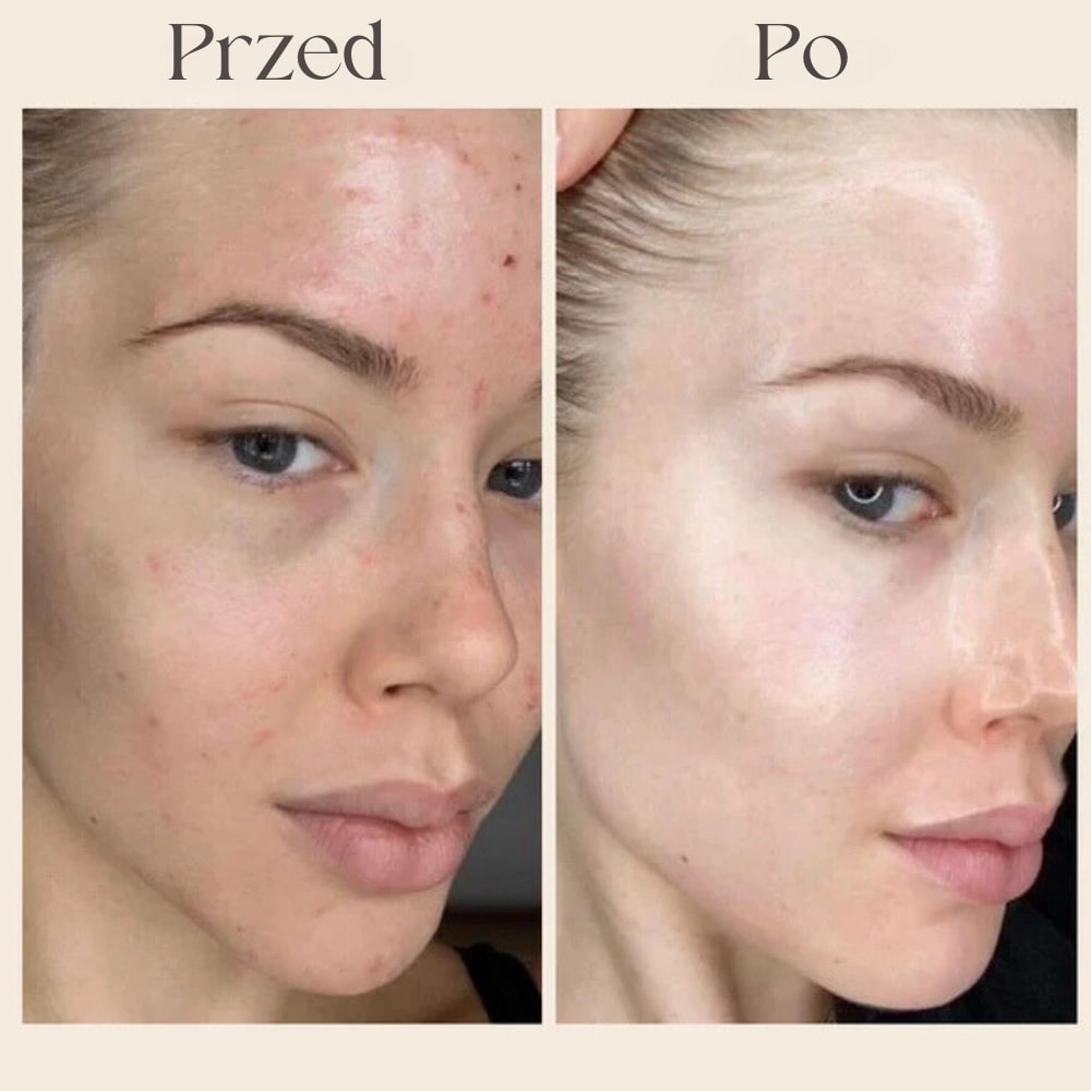 Przed_Po_3_MASKA_KOLAGENOWA.jpg