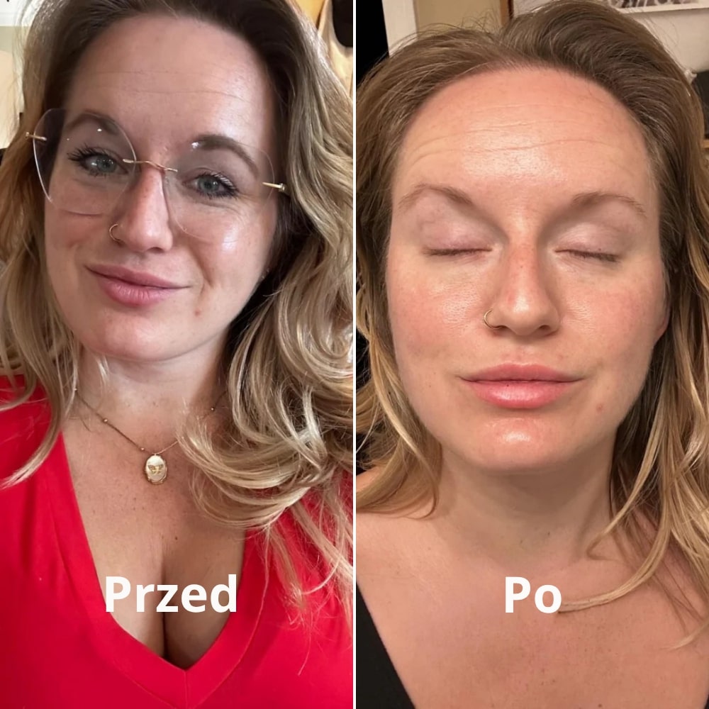 ODYLLA® - MASKA KOLAGENOWA