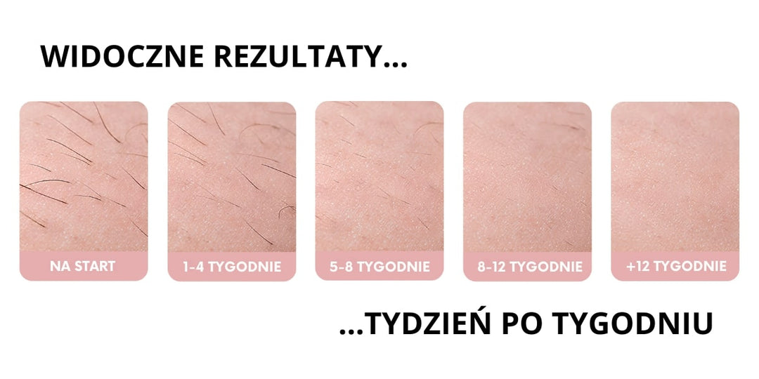 Efekty regularnej depilacji IPL tydzień po tygodniu